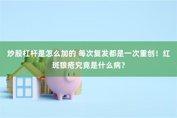 炒股杠杆是怎么加的 每次复发都是一次重创！红斑狼疮究竟是什么病？